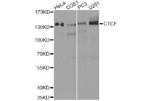 Western blot analysis of extracts of various cell lines, using CTCF antibody. (CTCF 抗体  (AA 1-260))
