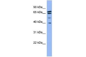 WB Suggested Anti-SH3GL2  Antibody Titration: 0. (SH3G2 抗体  (Middle Region))