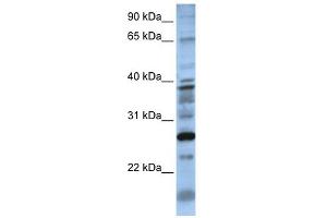 WB Suggested Anti-DOLPP1 Antibody Titration:  0. (DOLPP1 抗体  (N-Term))