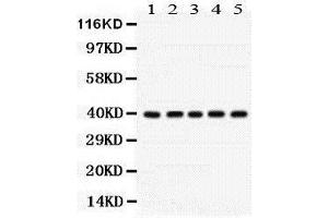 Western Blotting (WB) image for anti-Cyclin-Dependent Kinase 7 (CDK7) (AA 31-346) antibody (ABIN3042742) (CDK7 抗体  (AA 31-346))