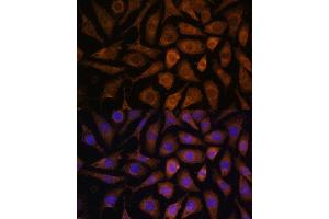 Immunofluorescence analysis of L929 cells using M Polyclonal Antibody (ABIN7268628) at dilution of 1:100 (40x lens). (MAPK6 抗体  (AA 372-721))