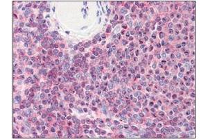 Immunohistochemistry (IHC) image for anti-Cofilin 1 (CFL1) (AA 1-166), (N-Term) antibody (ABIN336102) (Cofilin 抗体  (N-Term))