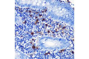 Immunohistochemistry (IHC) image for anti-S100 Calcium Binding Protein B (S100B) antibody (ABIN7270131)
