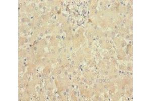 Immunohistochemistry of paraffin-embedded human liver tissue using ABIN7160100 at dilution of 1:100 (MLKL 抗体  (AA 1-471))
