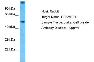 Host: Rabbit Target Name: PRAMEF1 Sample Type: Jurkat Whole Cell lysates Antibody Dilution: 1. (PRAMEF1 抗体  (N-Term))