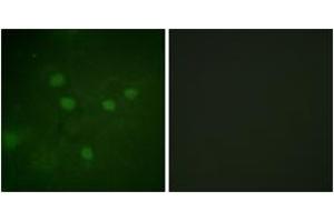 Immunofluorescence analysis of COS7 cells, using NFAT5 (Phospho-Ser1197) Antibody. (NFAT5 抗体  (pSer1197))