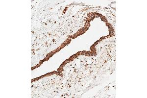 Immunohistochemistry (Paraffin-embedded Sections) (IHC (p)) image for anti-Sphingomyelin phosphodiesterase 1, Acid Lysosomal (SMPD1) (AA 391-419), (C-Term) antibody (ABIN656161)