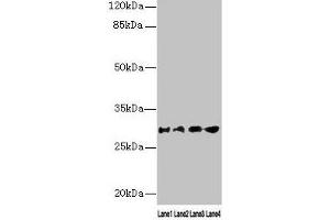Western blot All lanes: AQP1 antibody at 16 μg/mL Lane 1: Rat heart tissue Lane 2: Mouse skeletal muscle tissue Lane 3: A549 whole cell lysate Lane 4: 293T whole cell lysate Secondary Goat polyclonal to rabbit IgG at 1/10000 dilution Predicted band size: 29, 20, 24, 17 kDa Observed band size: 29 kDa (Aquaporin 1 抗体  (AA 220-269))