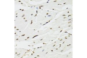 Immunohistochemistry of paraffin-embedded mouse heart using EDF1 antibody (ABIN5971272) at dilution of 1/100 (40x lens). (EDF1 抗体)