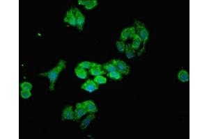Immunofluorescent analysis of HepG2 cells using ABIN7159567 at dilution of 1:100 and Alexa Fluor 488-congugated AffiniPure Goat Anti-Rabbit IgG(H+L) (MTX2 抗体  (AA 1-263))