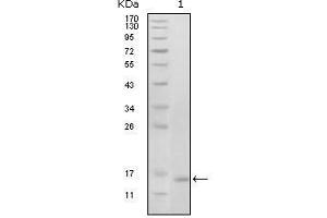 Western Blot showing EhpB6 antibody used against truncated EhpB6 recombinant protein (1). (EPH Receptor B6 抗体  (AA 601-750))