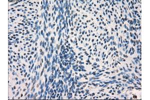 Immunohistochemical staining of paraffin-embedded endometrium tissue using anti-FRKmouse monoclonal antibody. (FRK 抗体)