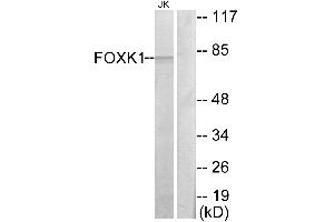 Western blot analysis of extracts from Jurkat cells, using FOXK1 antibody. (Foxk1 抗体  (C-Term))