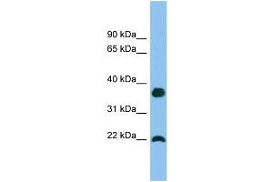 WB Suggested Anti-WFDC1 Antibody Titration: 0. (WFDC1 抗体  (Middle Region))