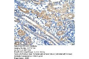 Rabbit Anti-RPUSD2 Antibody  Paraffin Embedded Tissue: Human Kidney Cellular Data: Epithelial cells of renal tubule Antibody Concentration: 4. (RPUSD2 抗体  (N-Term))