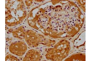 IHC image of ABIN7159941 diluted at 1:400 and staining in paraffin-embedded human kidney tissue performed on a Leica BondTM system. (RHOT2 抗体  (AA 84-300))