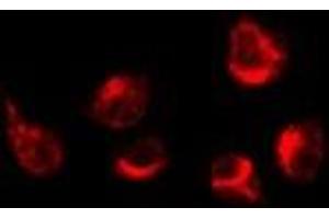 Immunofluorescence (fixed cells) (IF/ICC) image for anti-G Protein-Coupled Receptor, Family C, Group 5, Member A (GPRC5A) (Internal Region) antibody (ABIN6258884)