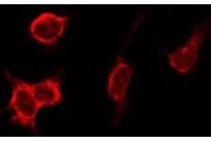 ABIN6275888 staining HeLa by IF/ICC. (Cathepsin D 抗体  (C-Term))