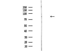 anti-Patatin-Like phospholipase Domain Containing 8 (PNPLA8) (C-Term) antibody
