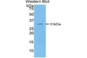 Western Blotting (WB) image for anti-Tubulin, epsilon 1 (TUBE1) (AA 236-473) antibody (ABIN3203922) (TUBE1 抗体  (AA 236-473))