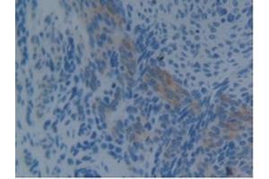 Detection of PDCD6IP in Mouse Uterus Tissue using Polyclonal Antibody to Programmed Cell Death Protein 6 Interacting Protein (PDCD6IP)