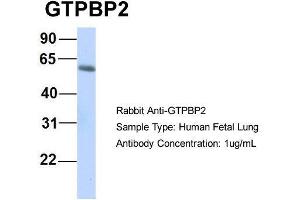 Host:  Rabbit  Target Name:  GTPBP2  Sample Type:  Human Fetal Lung  Antibody Dilution:  1. (GTPBP2 抗体  (N-Term))