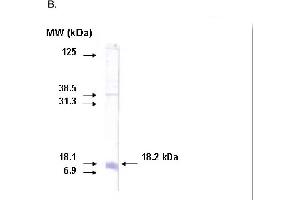 Western blot on recombinant protein corresponding to C-terminal region of CYP26A1 protein using CYP26A1 antibody. (CYP26A1 抗体  (C-Term))
