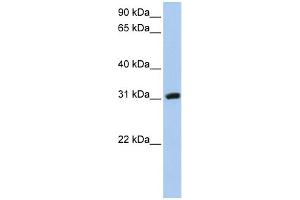 WB Suggested Anti-DKKL1 Antibody Titration: 0. (DKK1 抗体  (C-Term))