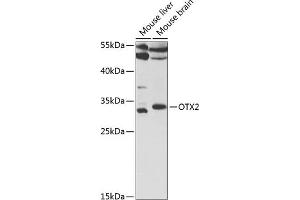 Western blot analysis of extracts of various cell lines, using OTX2 antibody (ABIN6131791, ABIN6145091, ABIN6145093 and ABIN6221138) at 1:1000 dilution. (OTX2 抗体  (AA 140-280))