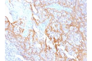 Formalin-fixed, paraffin-embedded human Tonsil stained with Beta-Catenin Mouse Monoclonal Antibody (15B8).