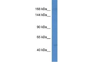 WB Suggested Anti-Setd5 Antibody   Titration: 1. (SETD5 抗体  (N-Term))