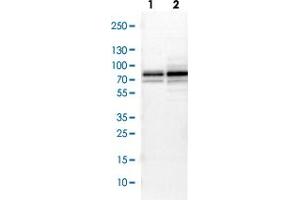 Western blot analysis of Lane 1: NIH-3T3 cell lysate (Mouse embryonic fibroblast cells) Lane 2: NBT-II cell lysate (Rat Wistar bladder tumour cells) with NF2 polyclonal antibody  at 1:500-1:1000 dilution.