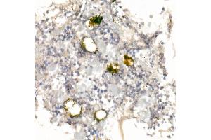 Immunohistochemistry of paraffin-embedded rat bone marrow using GP9 Rabbit pAb (ABIN6127598, ABIN6141293, ABIN6141294 and ABIN6221019) at dilution of 1:25 (40x lens). (CD42a 抗体  (AA 17-147))