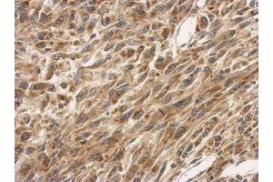 Immunohistochemistry (IHC) image for anti-Solute Carrier Family 25 (Mitochondrial Carrier, Oxoglutarate Carrier), Member 11 (SLC25A11) antibody (ABIN2855159)