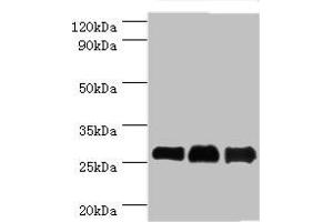 Western blot All lanes: B-cell lymphoma/leukemia 10 antibody at 9 μg/mL Lane 1: Mouse gonad tissue Lane 2: MCF-7 whole cell lysate Lane 3: NIH/3T3 whole cell lysate Secondary Goat polyclonal to rabbit IgG at 1/10000 dilution Predicted band size: 26 kDa Observed band size: 26 kDa