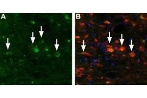 Expression of Mucolipin 3 in mouse brain stem - Immunohistochemical staining of TRPML3 in mouse brain stem using Anti-TRPML3 (Mucolipin 3) Antibody (ABIN7043338 and ABIN7044043). (Mucolipin 3 抗体  (Cytoplasmic Domain, Intracellular))