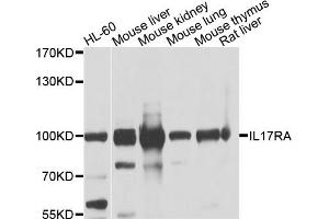 Western blot analysis of extracts of various cell lines, using IL17RA antibody. (IL17RA 抗体)