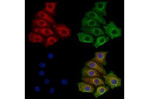 ABIN7094729 and ABIN7098780 staining HepG2 cells by IF/ICC. (STS 抗体  (C-Term))