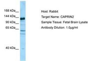 Image no. 1 for anti-Caprin Family Member 2 (CAPRIN2) (AA 924-973) antibody (ABIN6750090) (CAPRIN2 抗体  (AA 924-973))