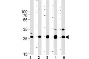 Sdhb antibody western blot analysis in human 1) HeLa, 2) HL-60, 3) mouse heart, 4) rat heart, and 5) zebrafish heart tissue lysate.