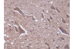 DAB staining on IHC-P; Samples: Rat Spinal cord Tissue (PKC delta 抗体  (AA 347-601))