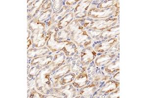 Immunohistochemistry of paraffin embedded rat kidney using Clcn5 (ABIN7073471) at dilution of 1:200 (400x lens) (Chloride Channel 5 抗体)