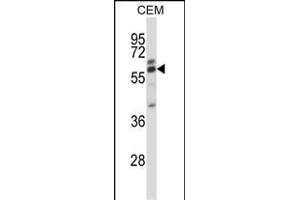 CORO2A Antibody (Center) (ABIN657512 and ABIN2846536) western blot analysis in CEM cell line lysates (35 μg/lane). (CORO2A 抗体  (AA 185-213))