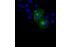 Image no. 12 for anti-Amyloid beta (A4) Precursor Protein (APP) antibody (ABIN1496877) (APP 抗体)