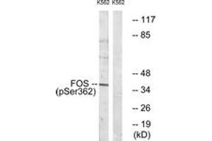 Western blot analysis of extracts from K562 cells treated with forskolin 40nM 30', using Fos (Phospho-Ser362) Antibody. (c-FOS 抗体  (pSer362))