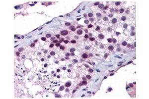 Immunohistochemistry (IHC) image for anti-Homeobox A5 (HOXA5) (Middle Region) antibody (ABIN2777305)