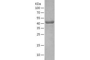 Arc Protein (AA 1-396) (His tag)