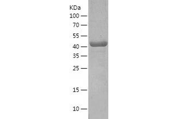 Arc Protein (AA 1-396) (His tag)