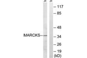 Western blot analysis of extracts from Jurkat cells, using MARCKS (Ab-158) Antibody. (MARCKS 抗体  (AA 126-175))
