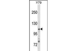 JMY Antibody (N-term) (ABIN1881469 and ABIN2838360) western blot analysis in Y79 cell line lysates (35 μg/lane). (JMY 抗体  (N-Term))